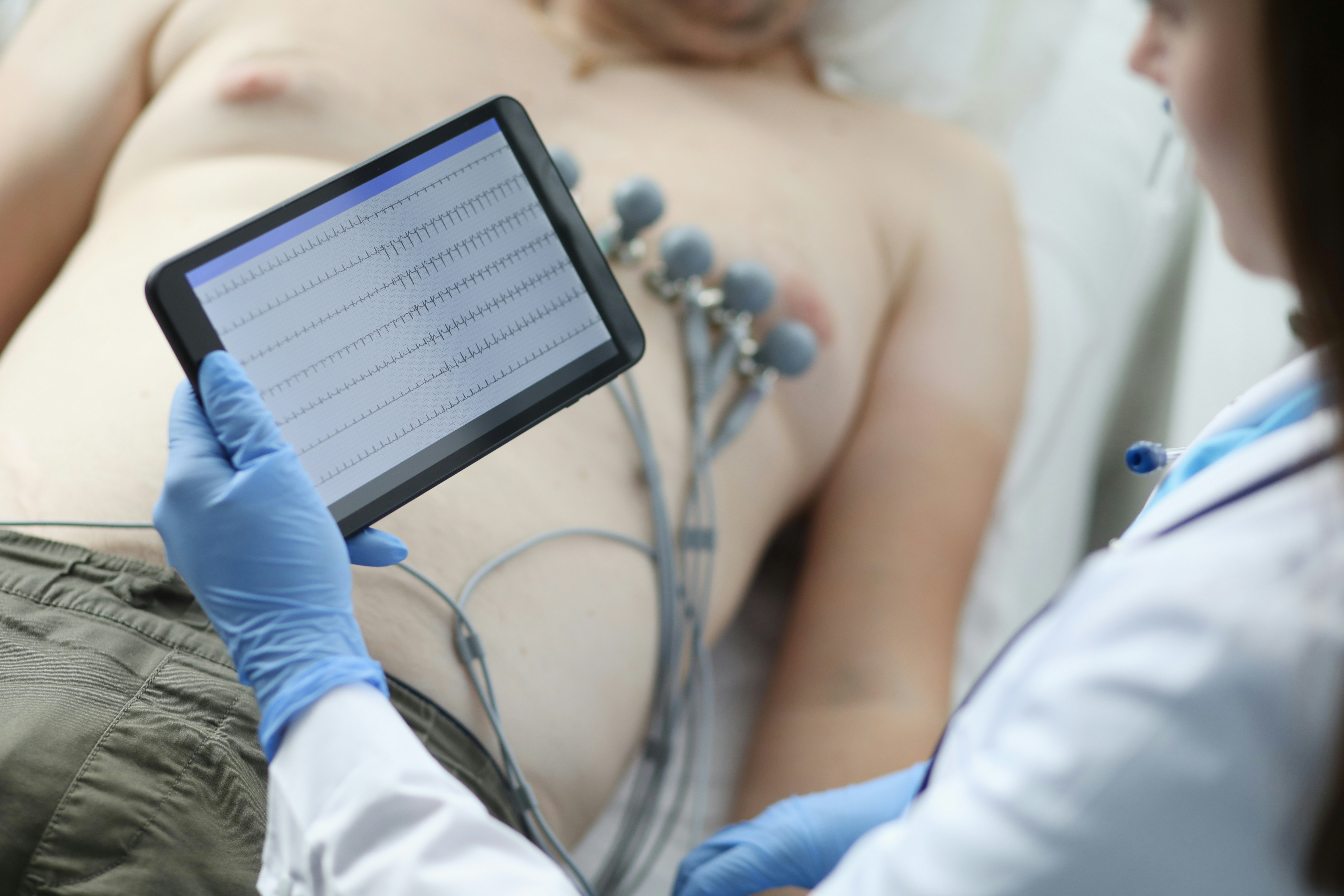 EKG