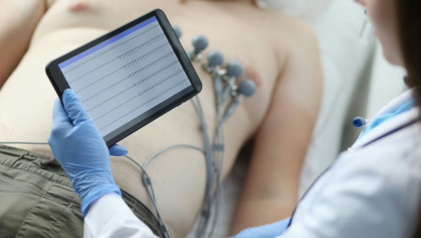 EKG