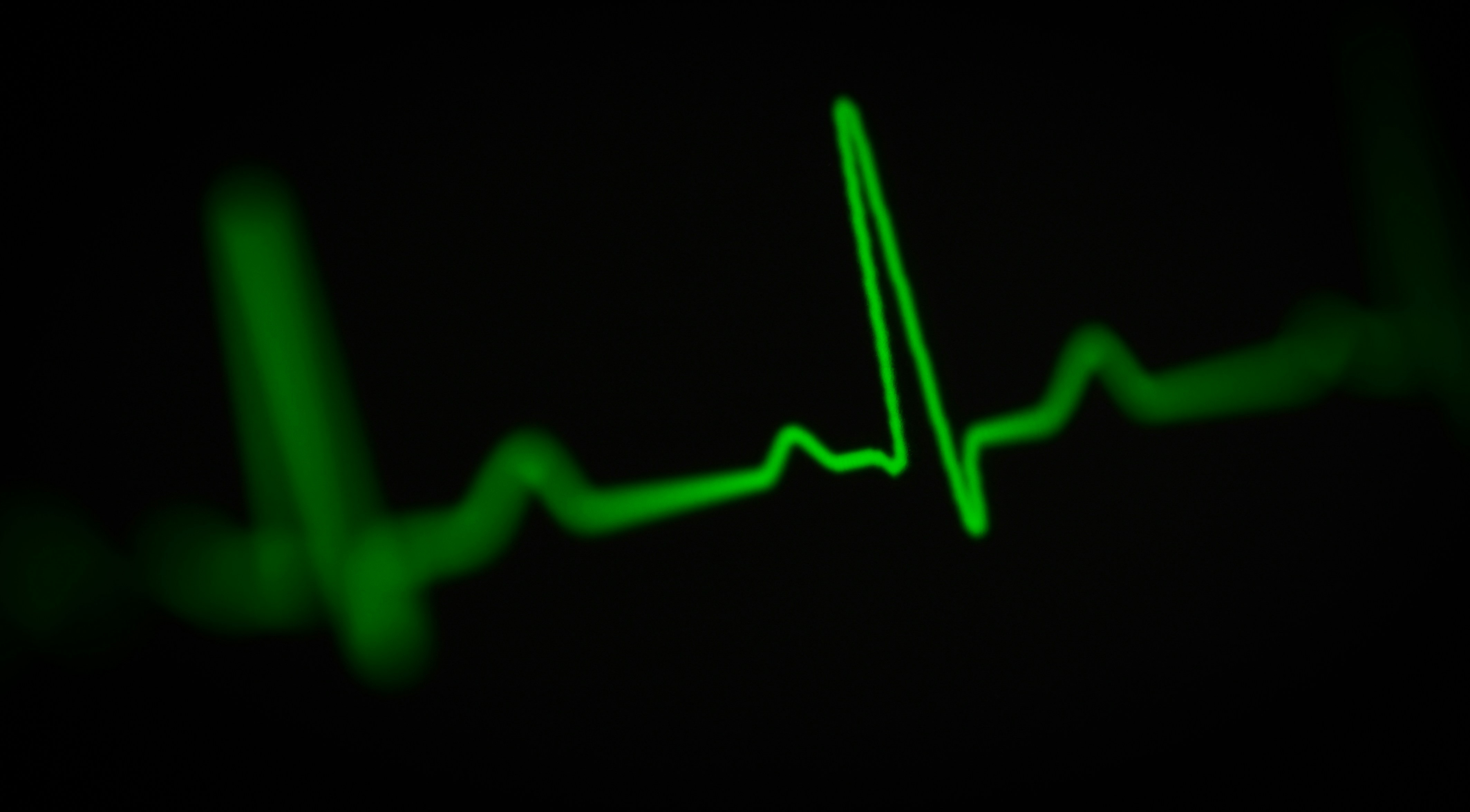 Holter EKG