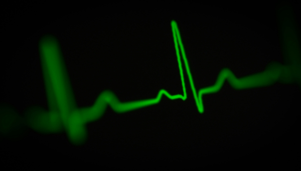 Holter EKG